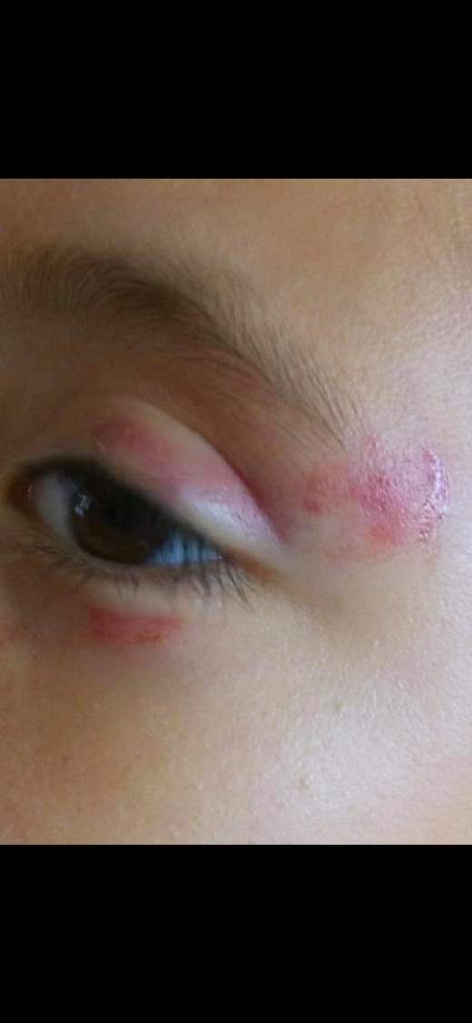 2 agresion - copia