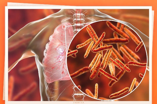 1 COPIA HAY 168 CASOS NUEVOS