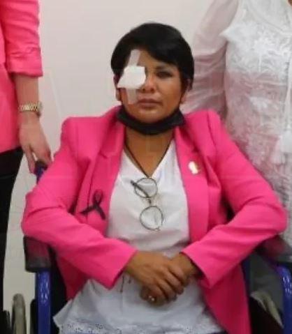 1 OJO