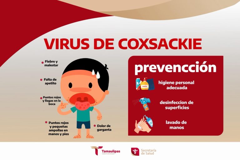 2 VIRUS